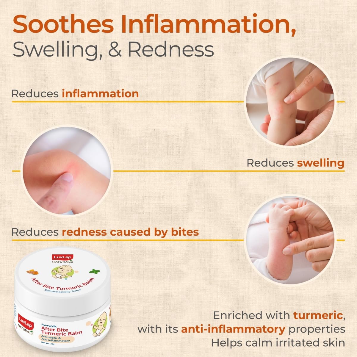 LuvLap Ayurvedic After Bite Turmeric Balm